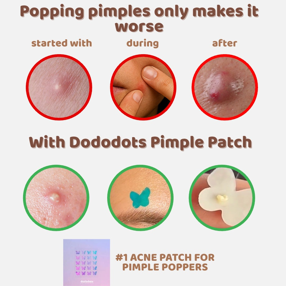 Dododots Nice Buns, Huns 20 pcs
