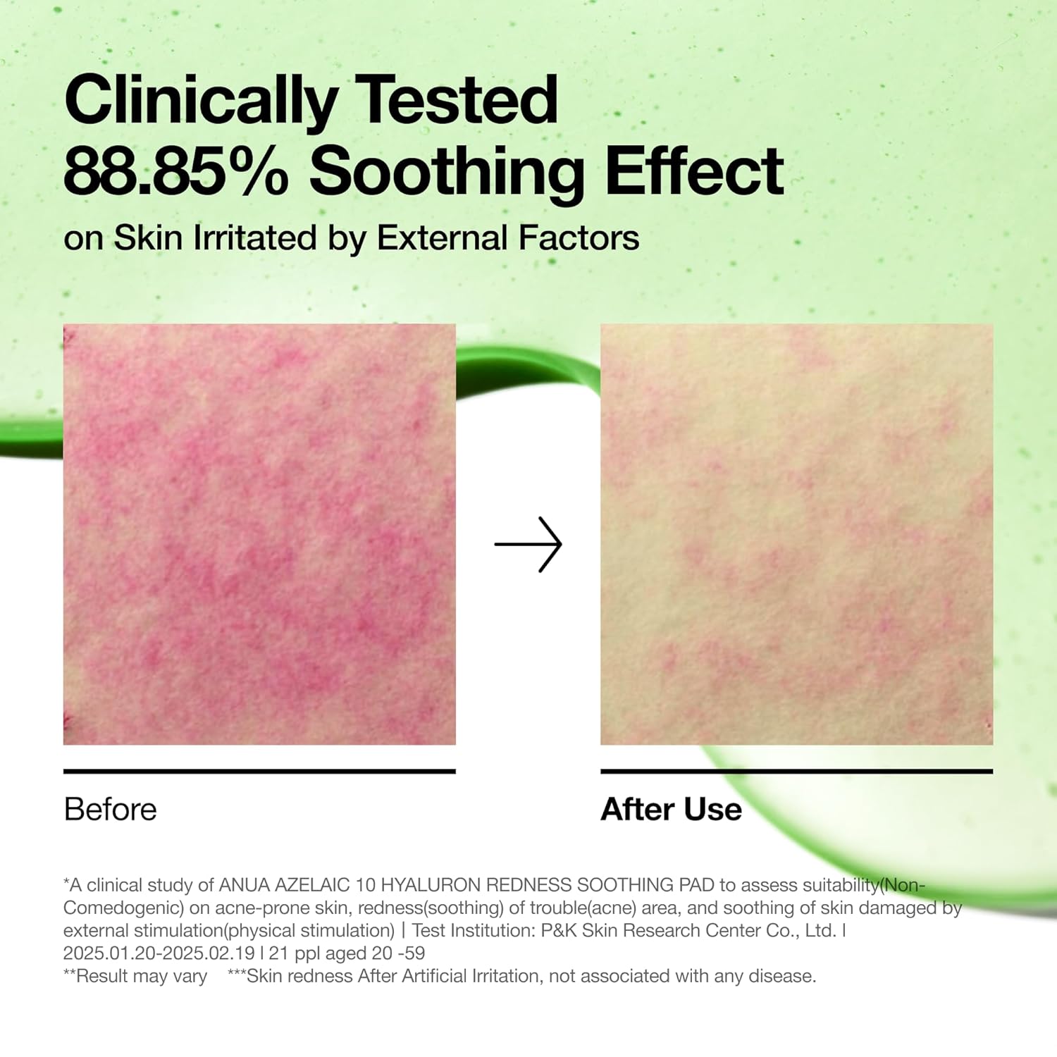 Anua Azelaic Acid 10 Hyaluron Redness Soothing Pad 90 pads by Anua – Toner Pads
