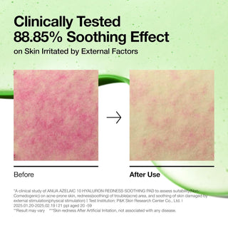 Anua Azelaic Acid 10 Hyaluron Redness Soothing Pad 90 pads by Anua – Toner Pads photo