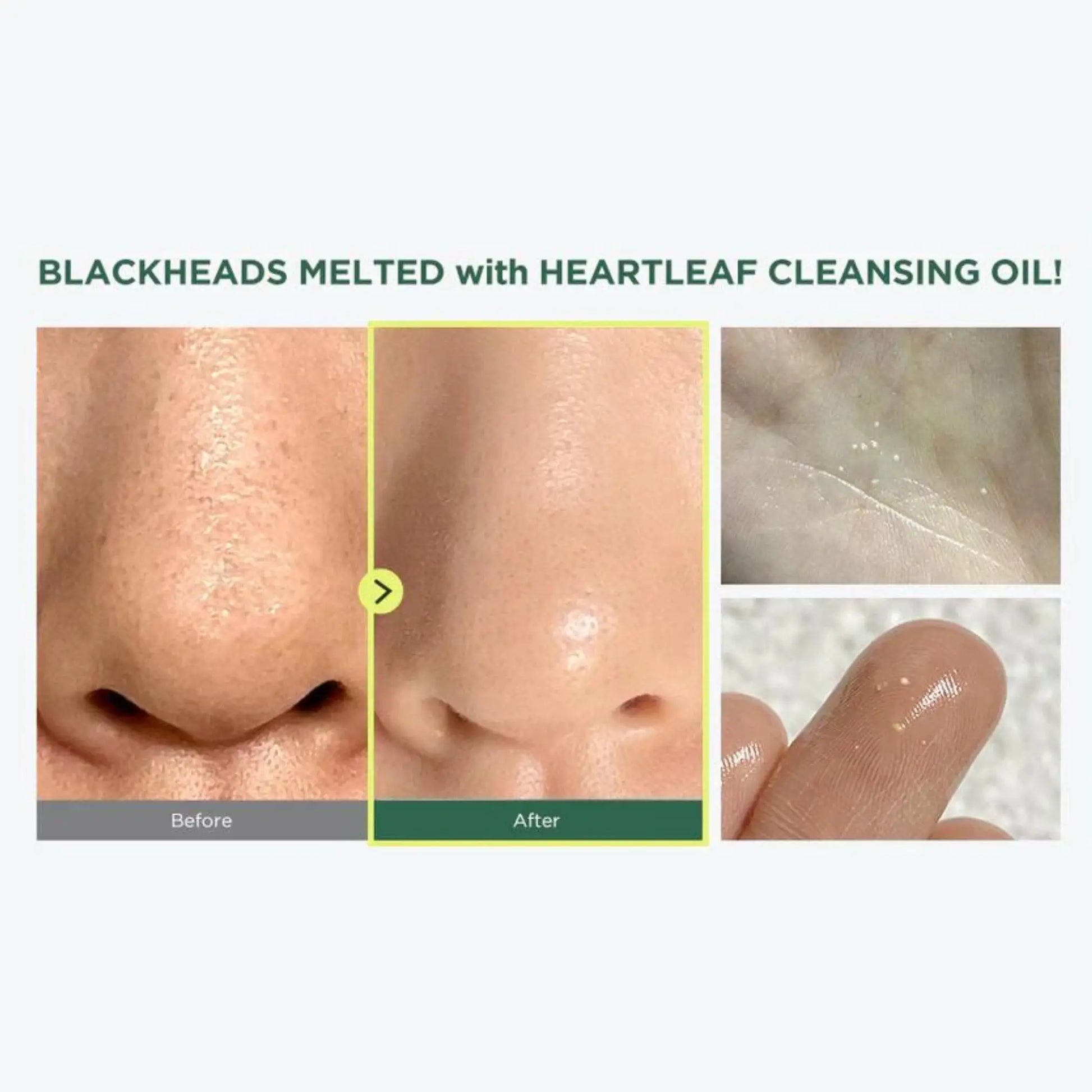 Anua Heartleaf Pore Control Cleansing Oil Mild 200ml by Anua – Makeup Remover