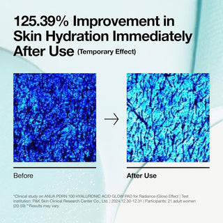 Anua PDRN Hyaluronic Glow Pad 60 pads by Anua – Toner Pads photo