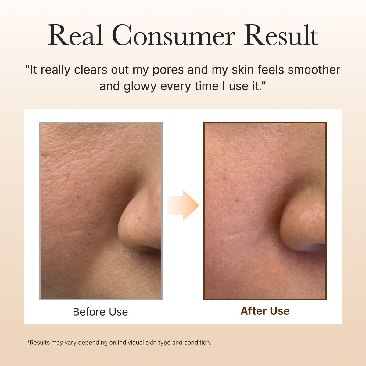 Arencia Laromatique Calendula Cleanser 120g by Arencia – Facial Cleanser