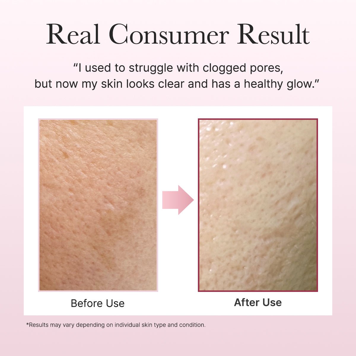 Arencia Royal Rosehip Rice Mochi Cleanser 120g by Arencia – Facial Cleanser