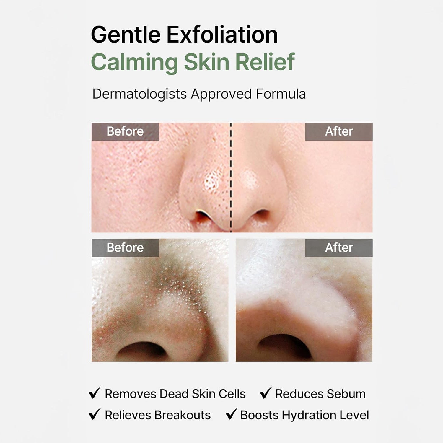 Celimax Ji Woo Gae Heartleaf BHA Peeling Pad 60pcs by Celimax – Toner Pads