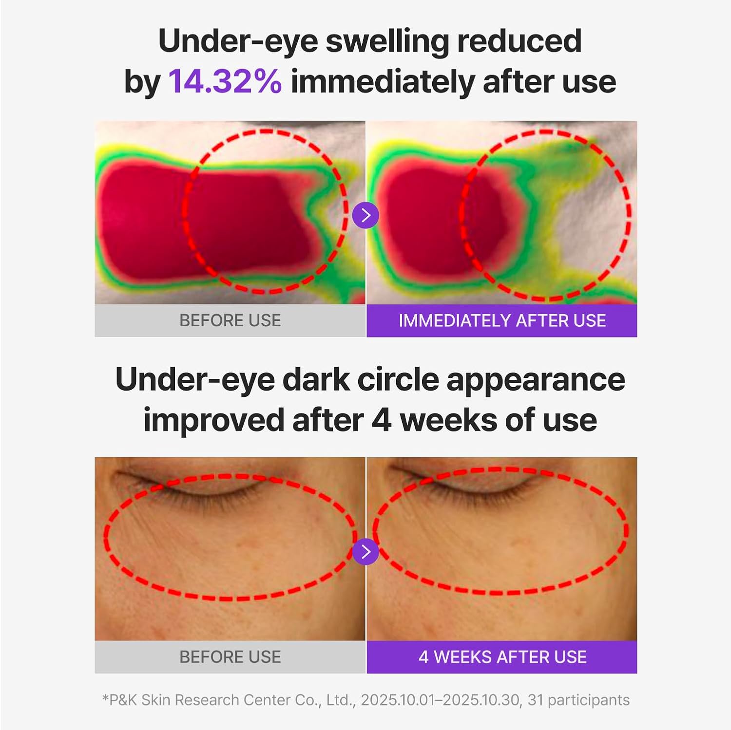Centellian24 360 Shot PDRN Glowing Eye Patch 6 Pairs by Centellian24 – Eye Masks