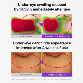 Centellian24 360 Shot PDRN Glowing Eye Patch 6 Pairs by Centellian24 – Eye Masks photo