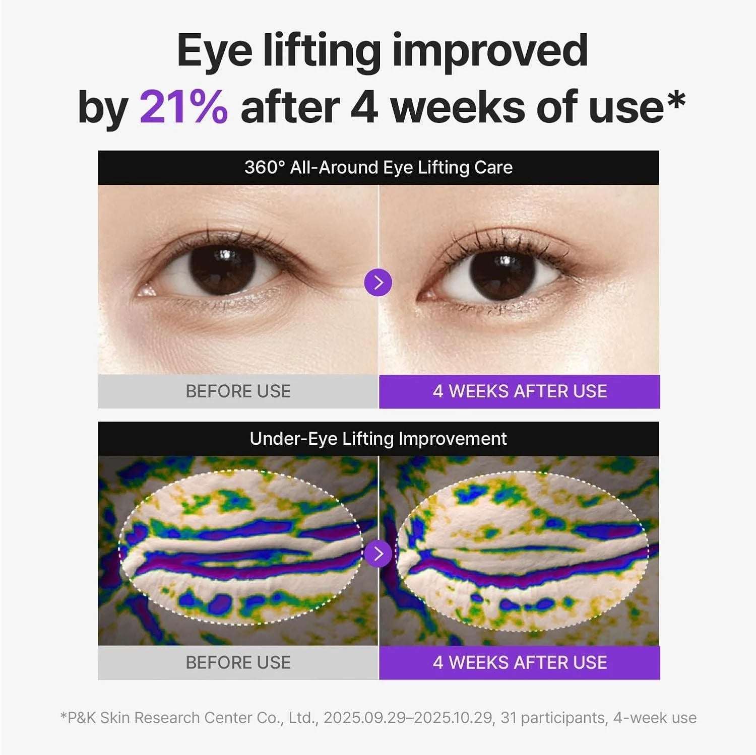 Centellian24 360 Shot PDRN Lifting Eye Cream 30ml by Centellian24 – Eye Cream & Serum