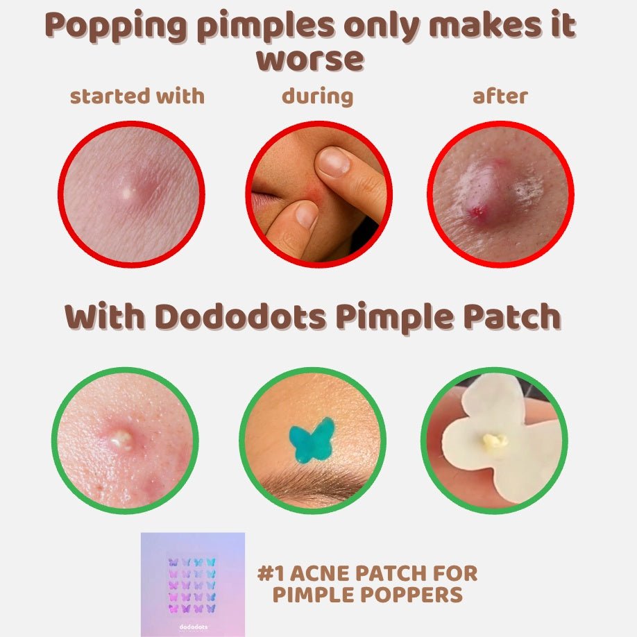 Dododots Slice, Slice Baby 25 pcs by DODODOTS – Pimple Patch