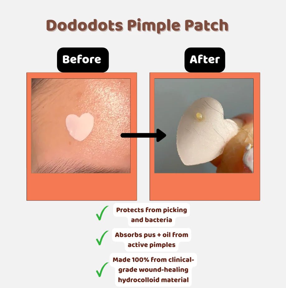 Dododots Slice, Slice Baby 25 pcs by DODODOTS – Pimple Patch