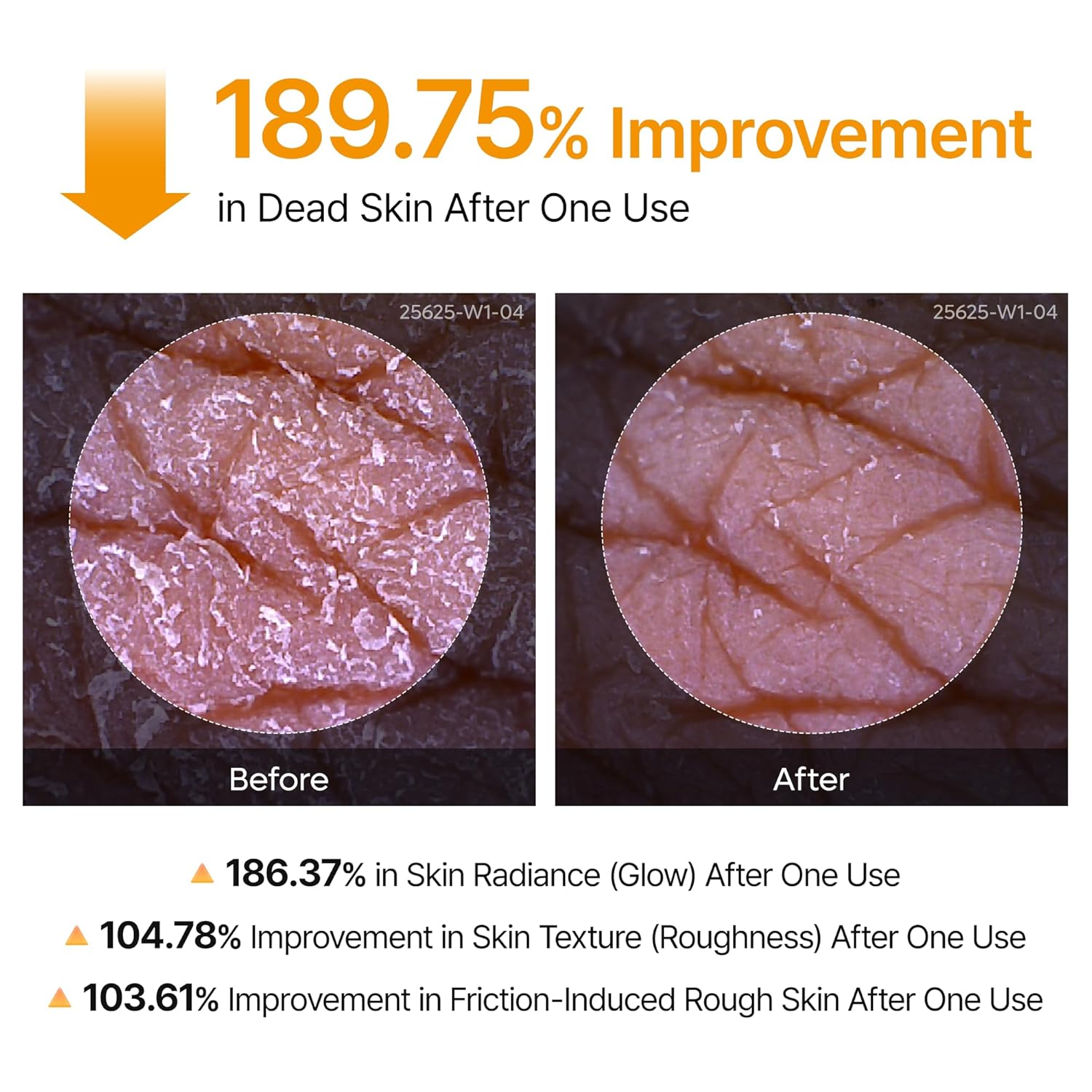 Dr. Melaxin Peel Shot Exfoliating Kojic Acid Turmeric Spray 200ml by Dr.Melaxin – Body Exfoliant