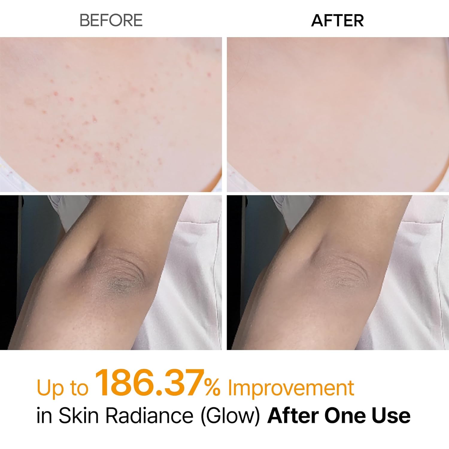Dr. Melaxin Peel Shot Exfoliating Kojic Acid Turmeric Spray 200ml by Dr.Melaxin – Body Exfoliant