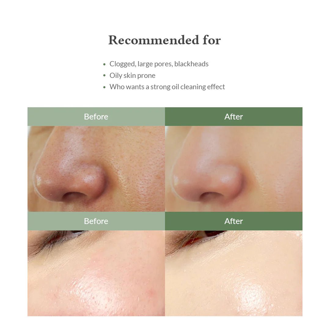 Dr.Althea Premium Quick Step Sebum Cleanser 100ml by Dr. Althea – Facial Cleanser