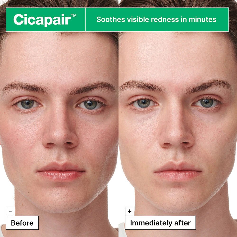 Dr.Jart Cicapair™ Sensitive Skin Serum Face Mask for Redness 5 Pack by Dr.Jart+ – Sheet Mask