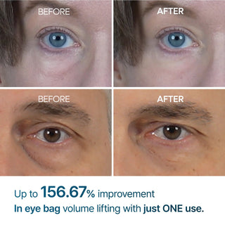 Dr.Melaxin Eyephalt Eyecream for Eyebags 10ml by Dr.Melaxin – Eye Cream & Serum photo