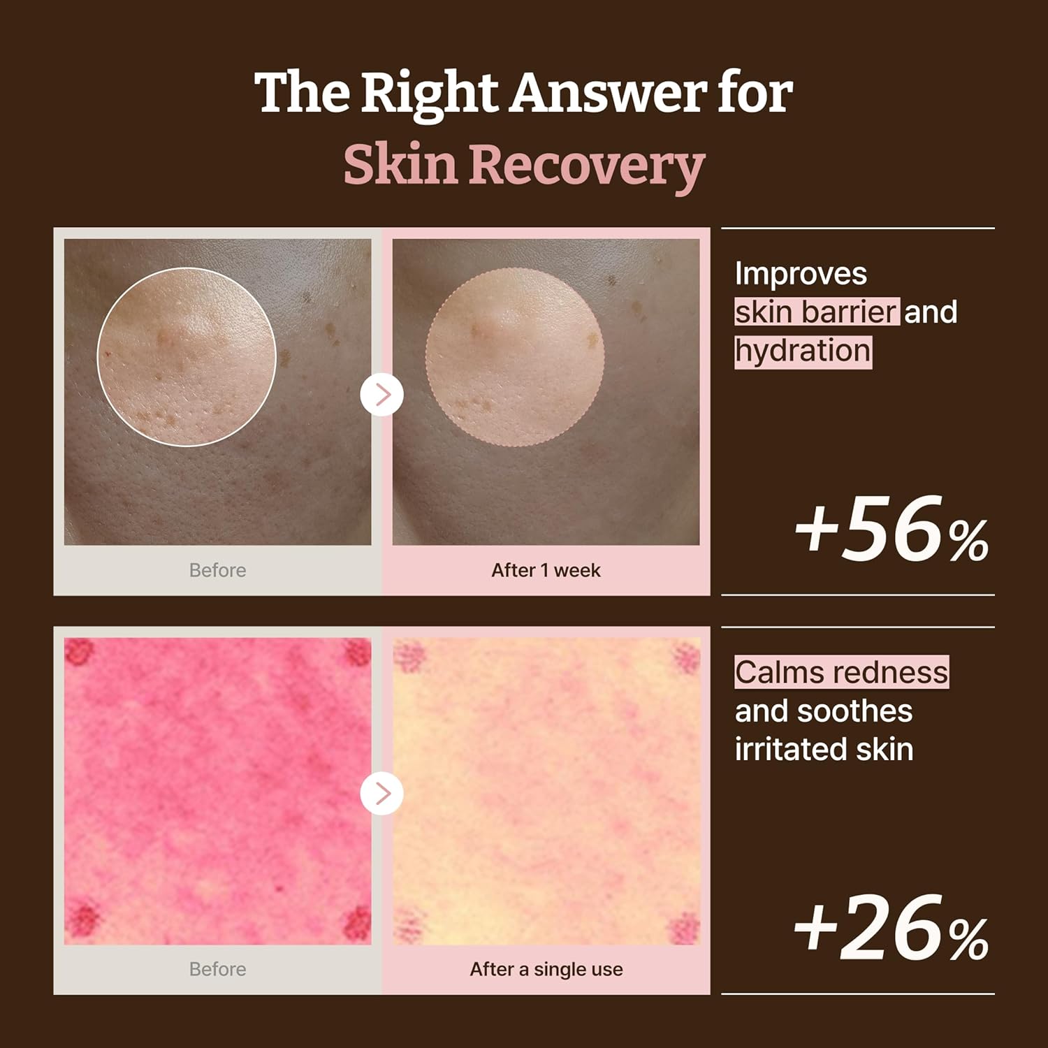 Dr.Reju - All Advanced PDRN Rejuvenating Cream 20ml by Dr. Reju - All – Lotion & Cream
