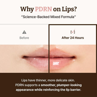 Dr.Reju - All Advanced PDRN Rejuvenating Lip Serum 10ml by Dr. Reju - All – Lip Treatment