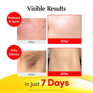 EQQUALBERRY Vitamin illuminating Serum 30ml by Eqqualberry – Serum & Ampoule