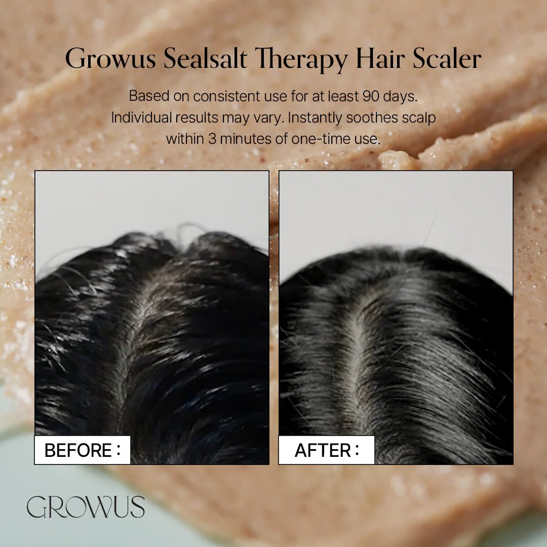 Growus Sea Salt Therapy Scalp Scaler 250g by GROWUS – Shampoo