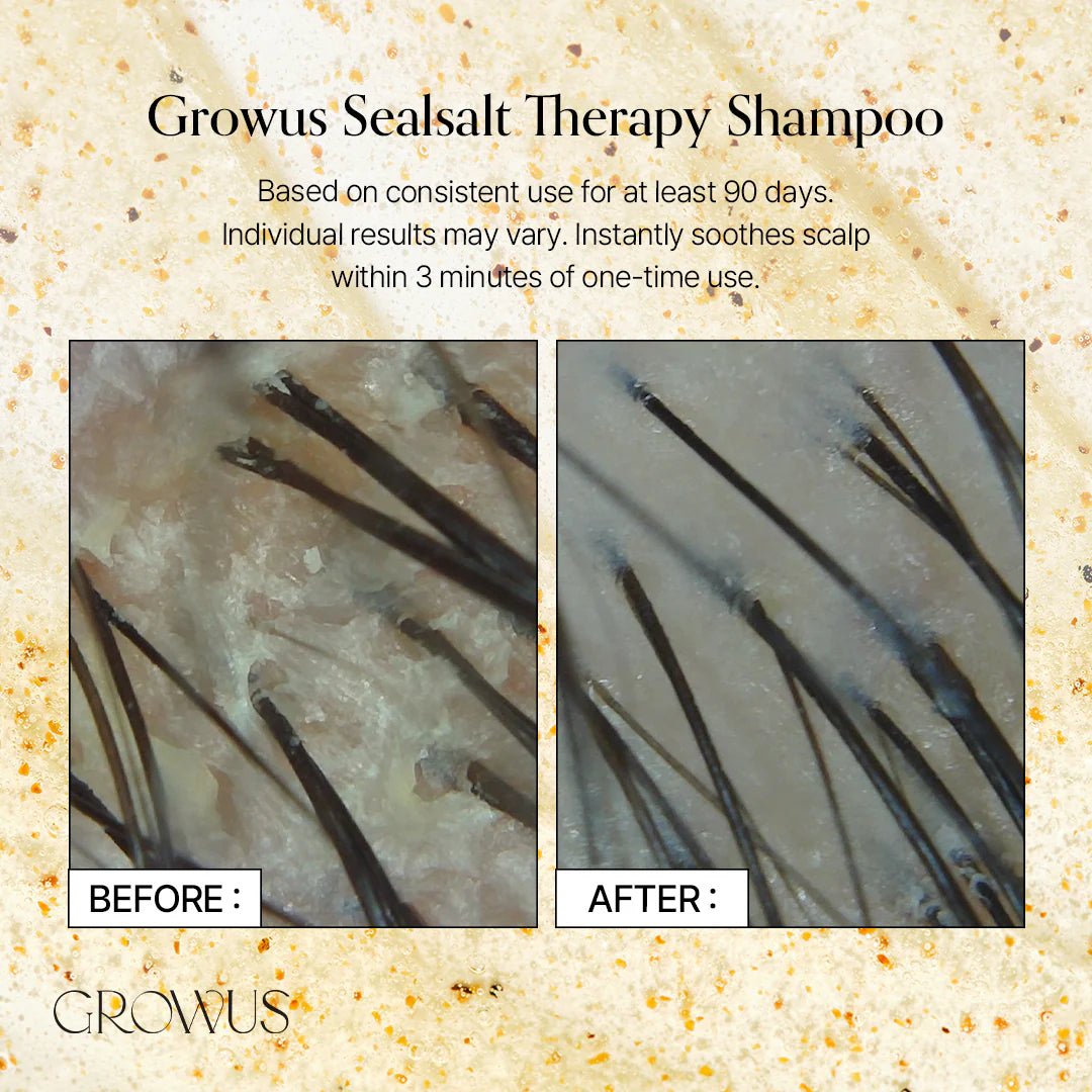 Growus Sea Salt Therapy Shampoo 500ml by GROWUS – Shampoo