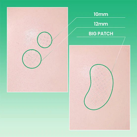 ilso No Problem Spot Patch 72P by ilso – Pimple Patch