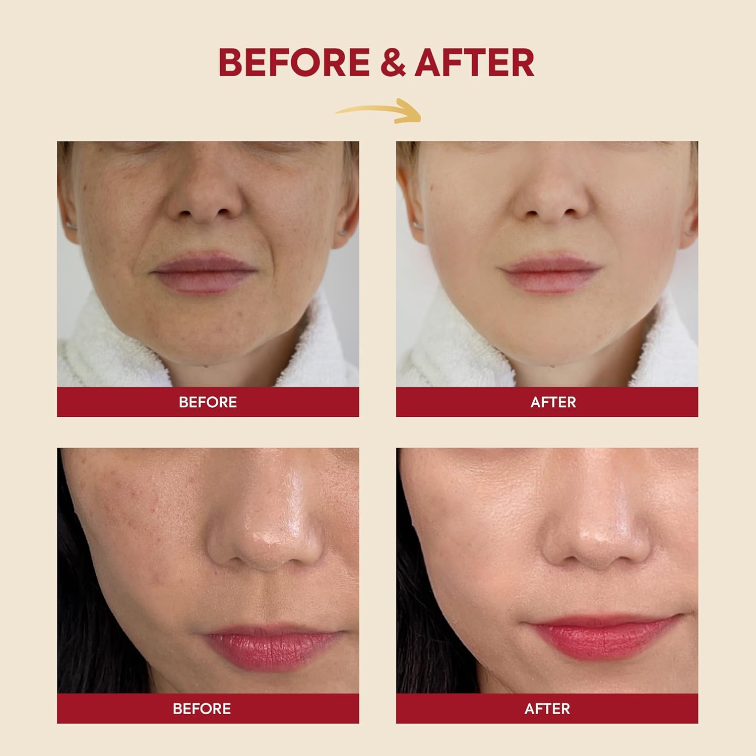 KSECRET SEOUL 1988 Essence: Snail Mucin 97% + Rice 100ml by KSECRET – Toner & Essence