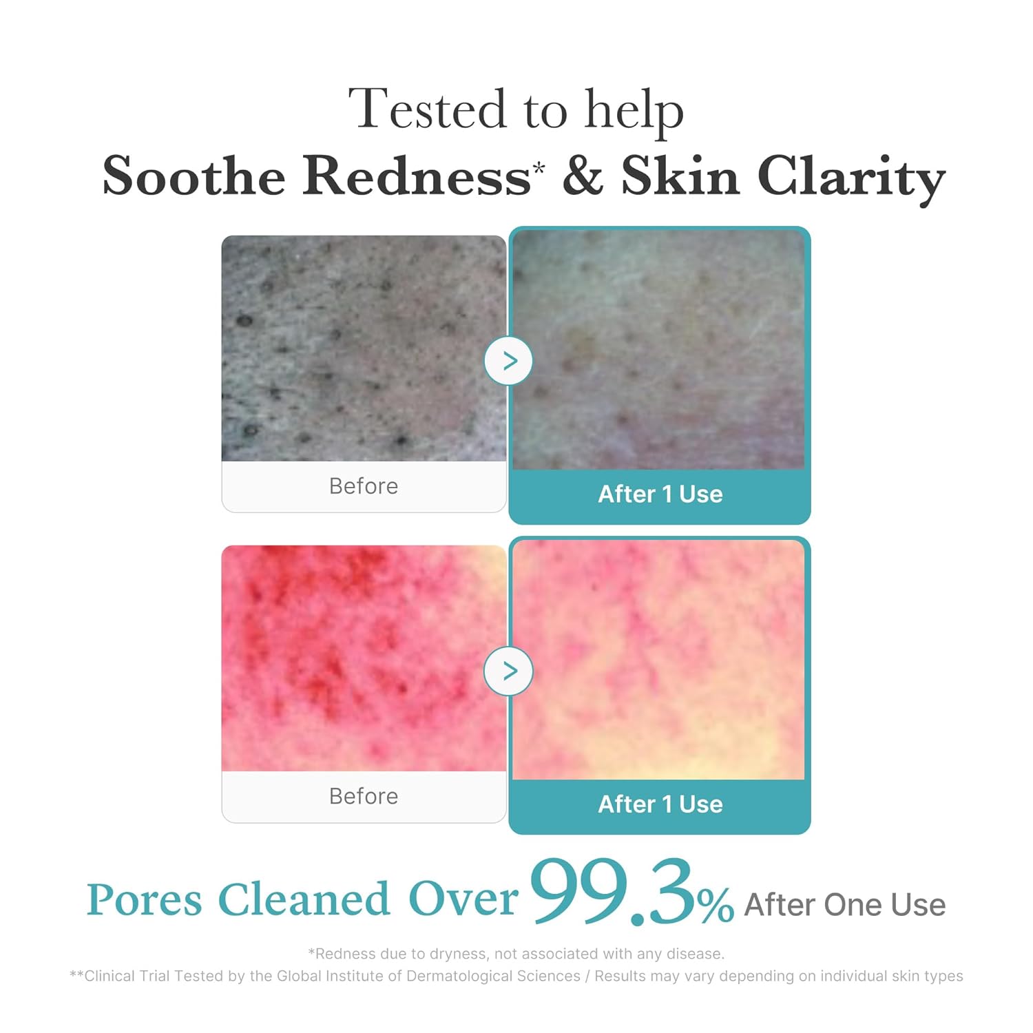 Medicube Azelaic Acid Niacinamide Deep Clean Foam Cleanser 120g by Medicube – Facial Cleanser
