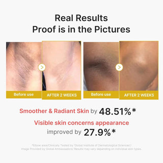 Medicube Kojic Acid Turmeric Body Peel Shot 280ml by Medicube – Body Lotion photo