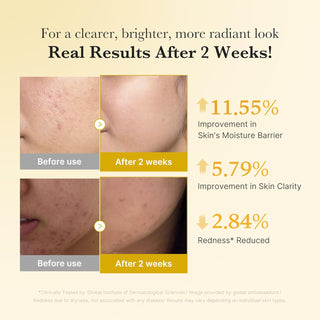 Medicube Kojic Acid Turmeric Niacinamide Serum 30ml by Medicube – Serum & Ampoule photo