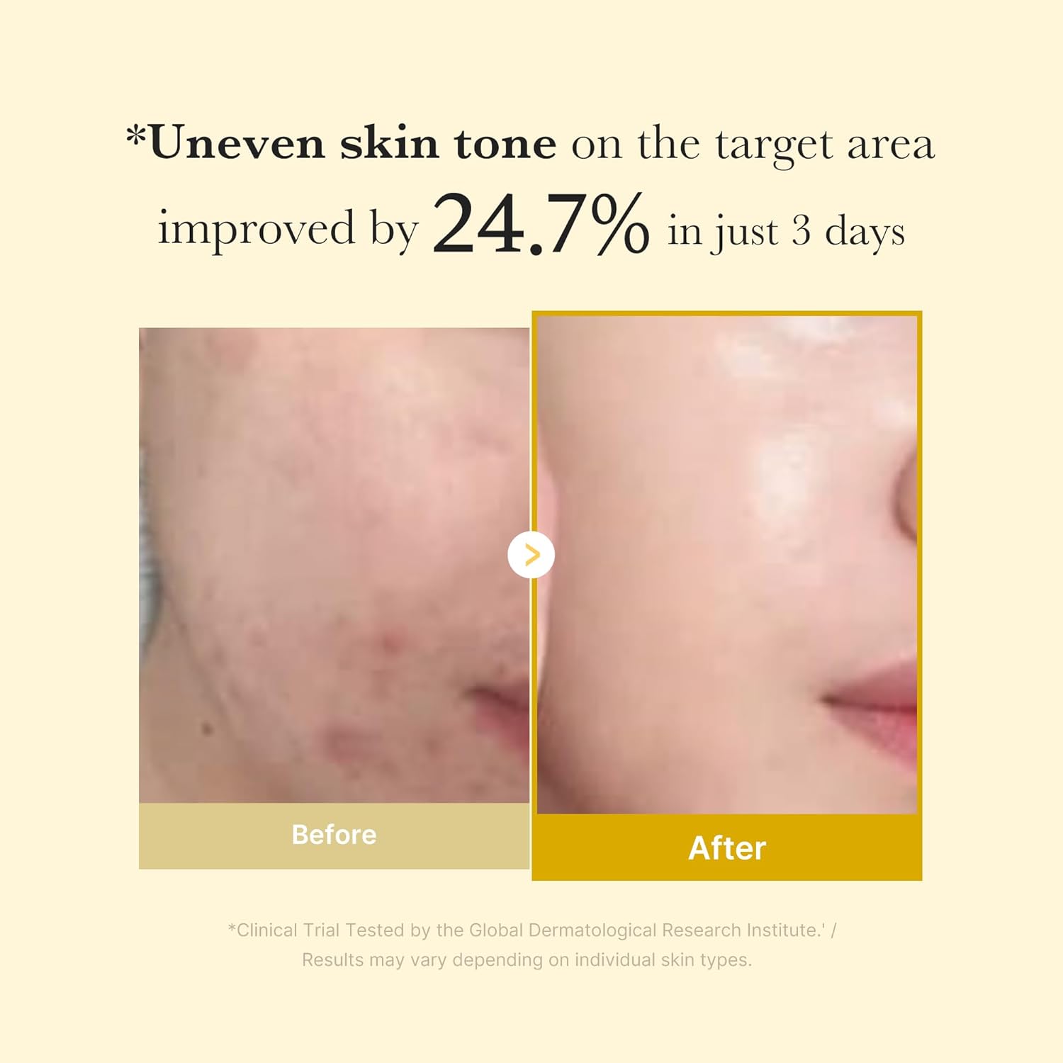Medicube Kojic Acid Turmeric Night Wrapping Mask 75ml by Medicube – Wrapping Mask