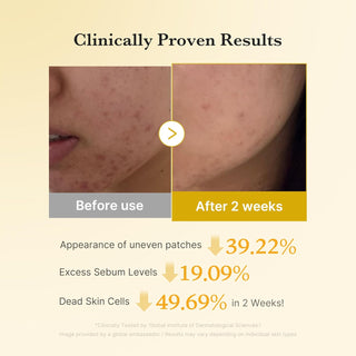 Medicube Kojic Acid Turmeric Pad 70ea by Medicube – Toner Pads photo