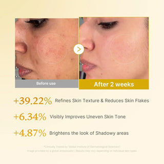 Medicube Kojic Acid Turmeric Toning Cleanser 120g by Medicube – Facial Cleanser