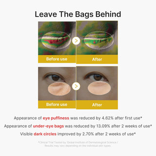 Medicube Kojic Acid Turmeric Vita Eye Gel Serum 30ml by Medicube – Eye Cream & Serum photo