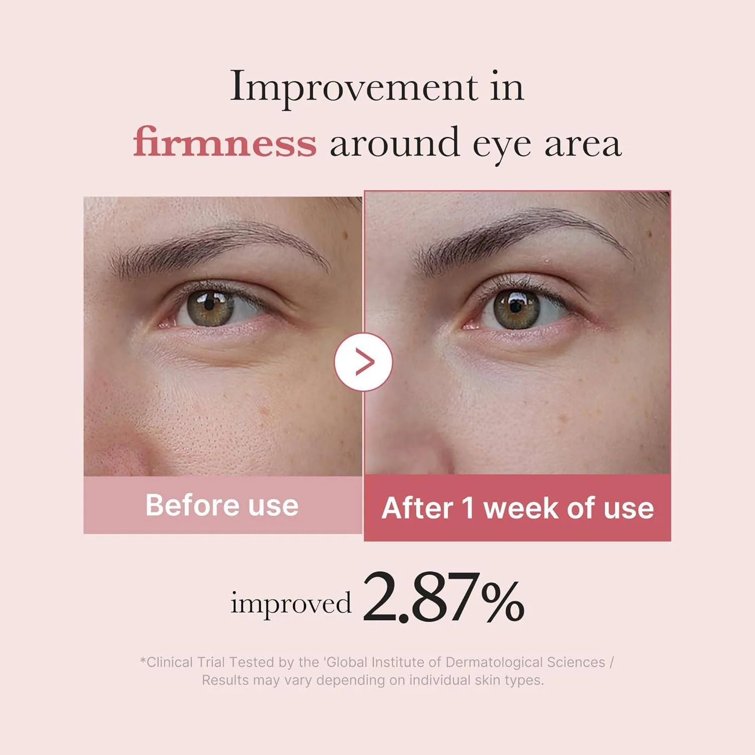 Medicube PDRN Pink Peptide Eye Cream 30ml by Medicube – Eye Cream & Serum