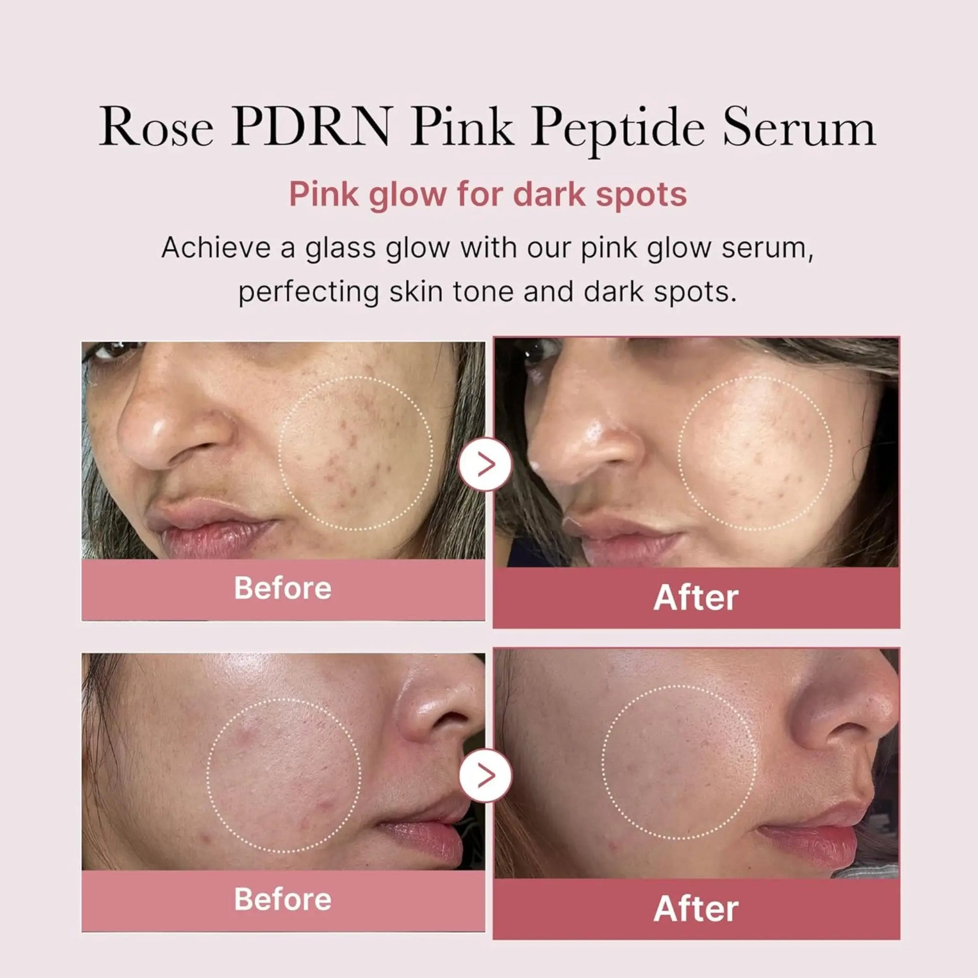 MEDICUBE PDRN Pink Peptide Serum 30ml by Medicube – Serum & Ampoule