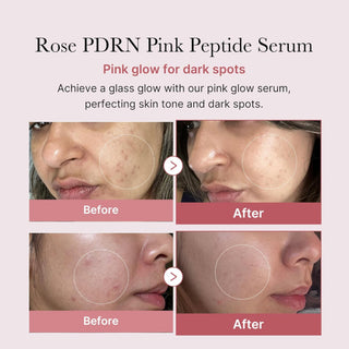 MEDICUBE PDRN Pink Peptide Serum 30ml - Medicube | Kiokii and...