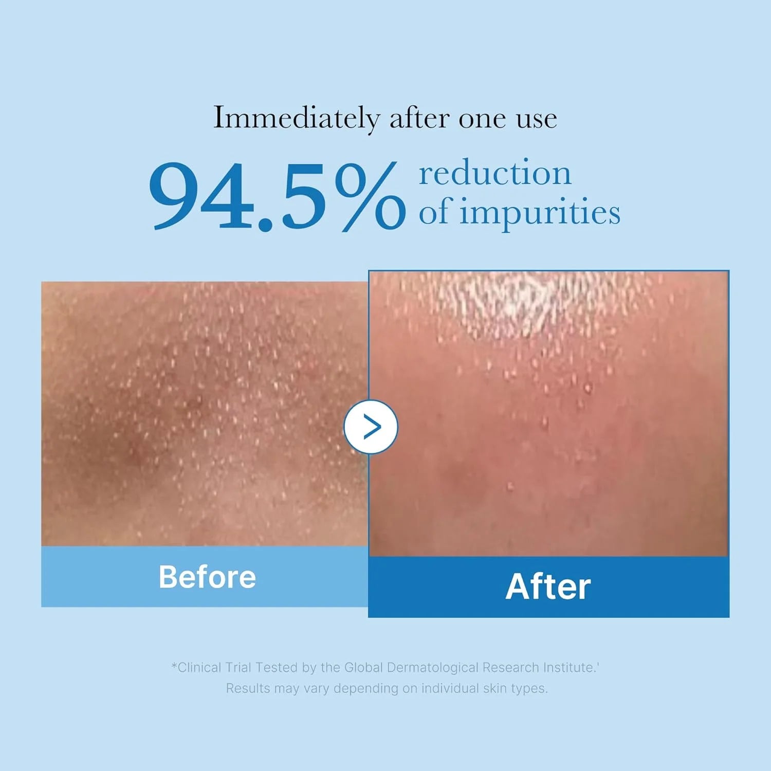 Medicube Zero Pore Blackhead Deep Cleansing Oil 205ml by Medicube – Makeup Remover