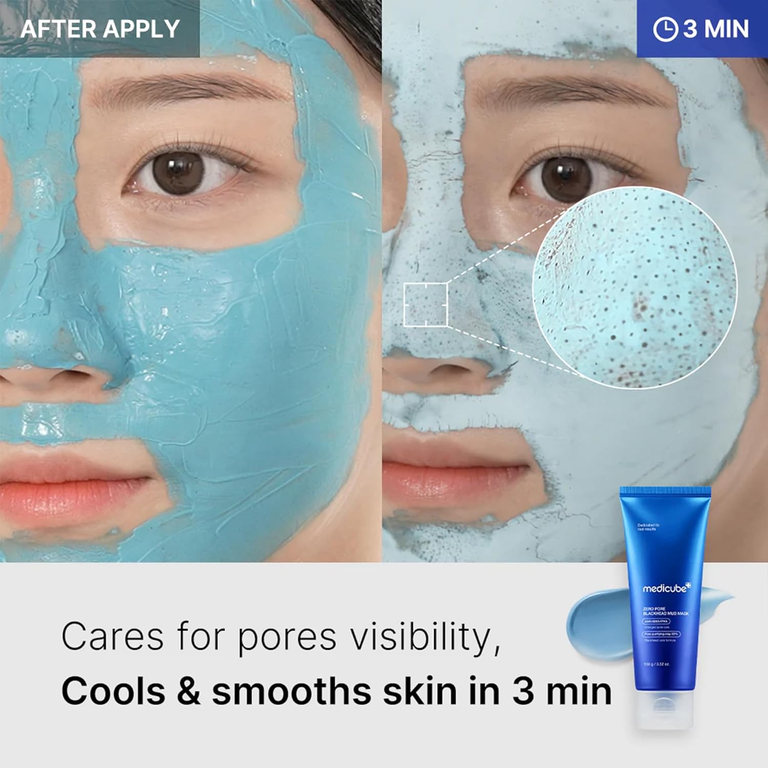 Medicube Zero Pore Blackhead Mud Mask 100g by Medicube – Wash - Off Mask