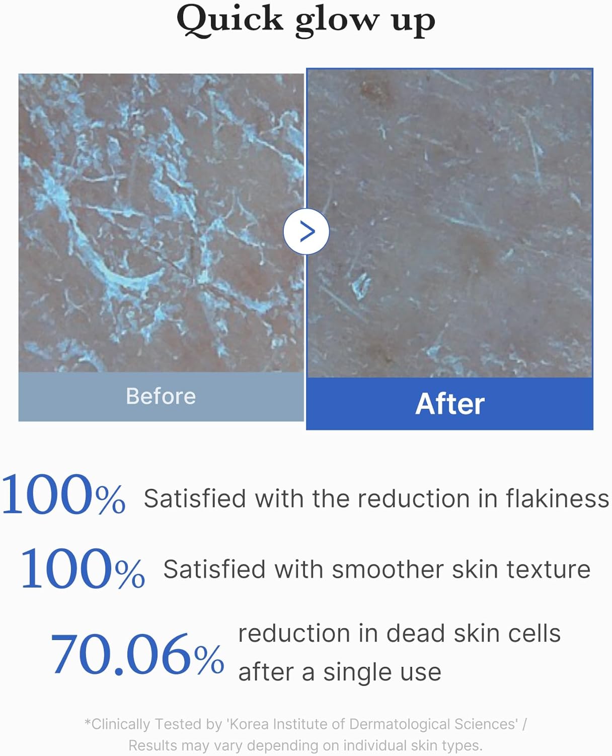 Medicube Zero Pore Peel Pad 8ea by Medicube – Toner Pads