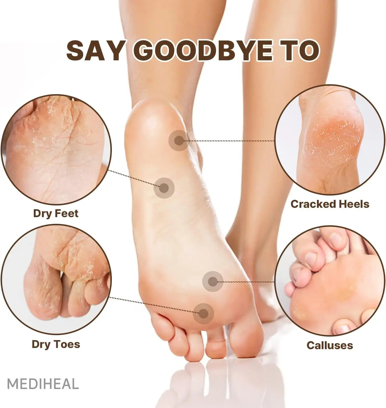 MEDIHEAL Derma Layer Foot Mask (5Packs) by Mediheal – Foot Care