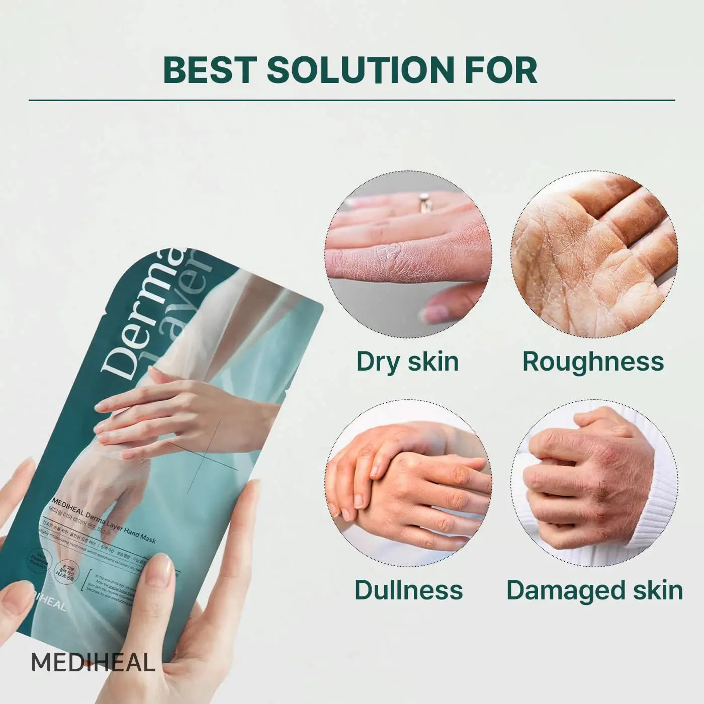 MEDIHEAL Derma Layer Hand Mask (5 Pack) by Mediheal – Hand Mask