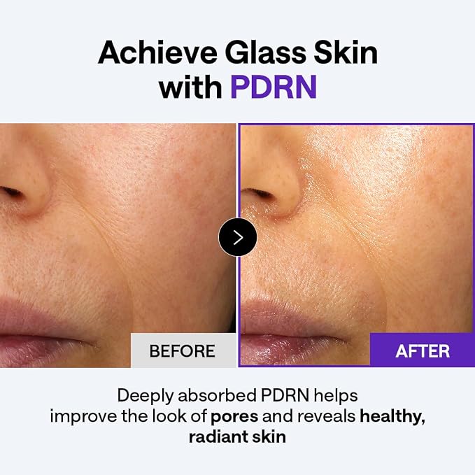 Mediheal PDRN Lifting Derma Cream 50ml by Mediheal –