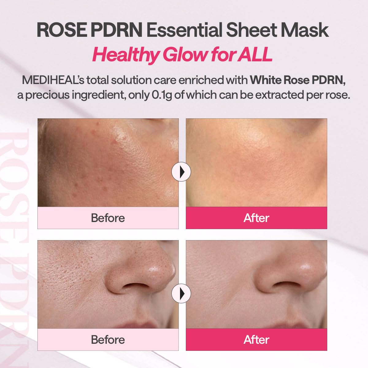 MEDIHEAL Rose PDRN Essential Mask 10pcs by Mediheal – Sheet Mask