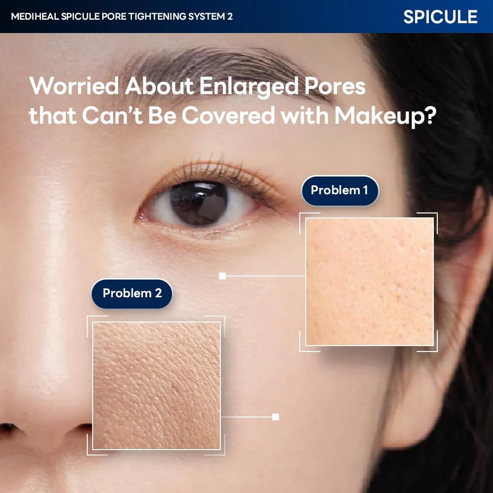 MEDIHEAL Spicule Pore Tightening System 1 Mask (4pcs) by Mediheal – Sheet Mask