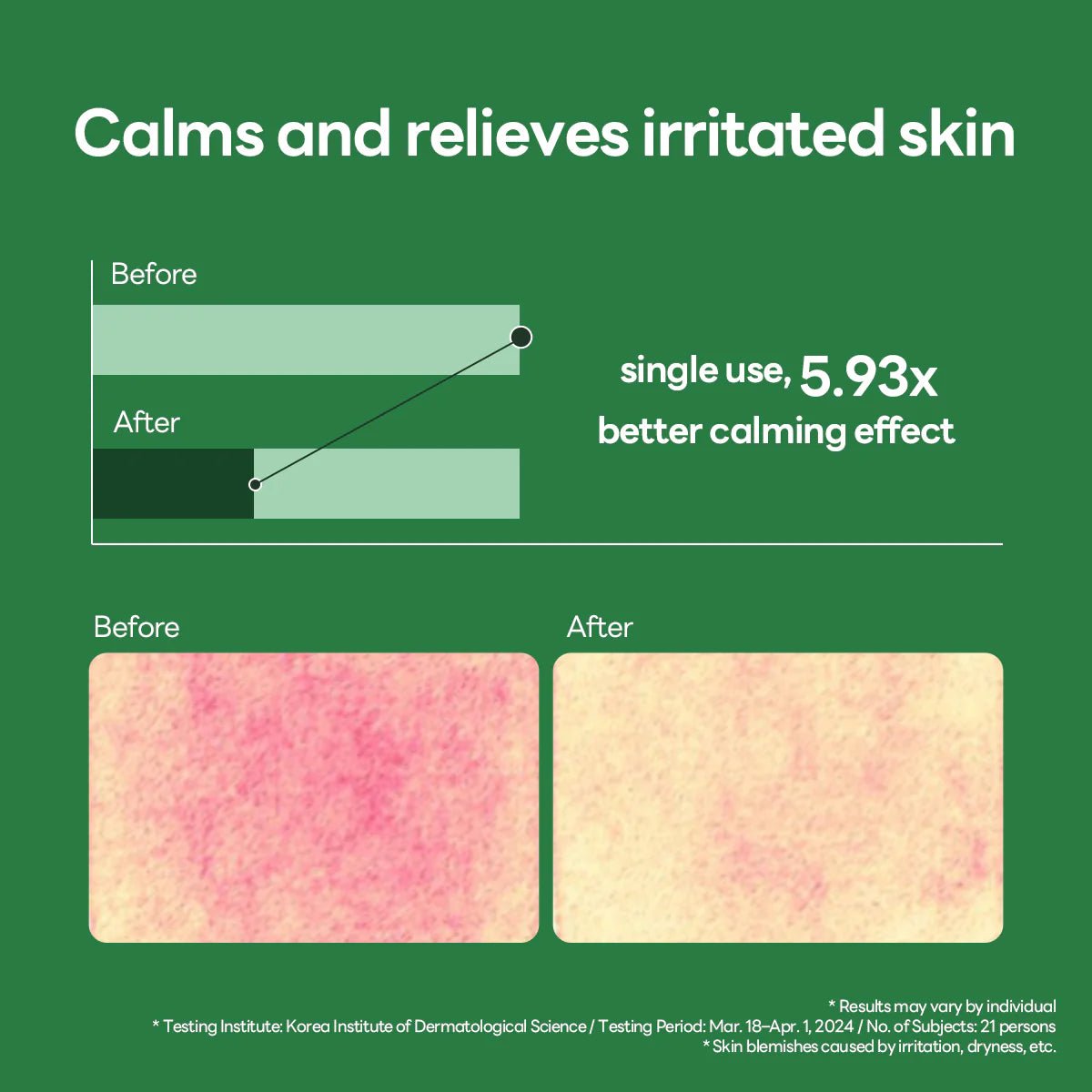MEDIHEAL Teatree Calming Hydra Serum 40ml by Mediheal – Serum & Ampoule