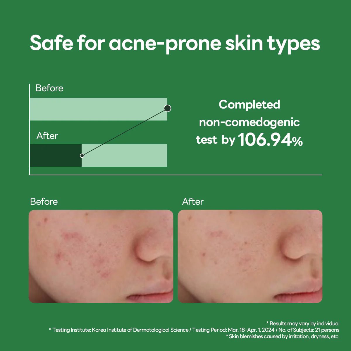 MEDIHEAL Teatree Calming Hydra Serum 40ml by Mediheal – Serum & Ampoule