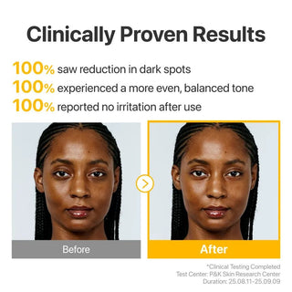 Numbuzin No 5 Glutathione TXA Advanced Dark Spot Ampoule Concentrate 10g by numbuzin – Serum & Ampoule photo