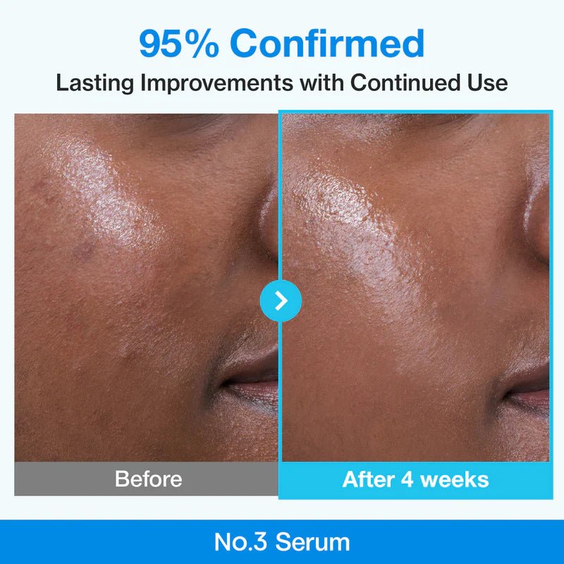 Numbuzin No.3 Blue Bio - Retinol Pore Refining Serum 30ml by numbuzin – Serum & Ampoule