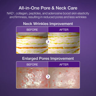 Numbuzin No.9 NAD Bio Lifting - sil Full Face Mask (Box 4pcs/Single) by numbuzin – Sheet Mask photo