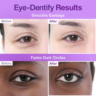 Numbuzin No.9 NAD+ Collagen Under Eye Patches 5pc by numbuzin – Eye Masks photo