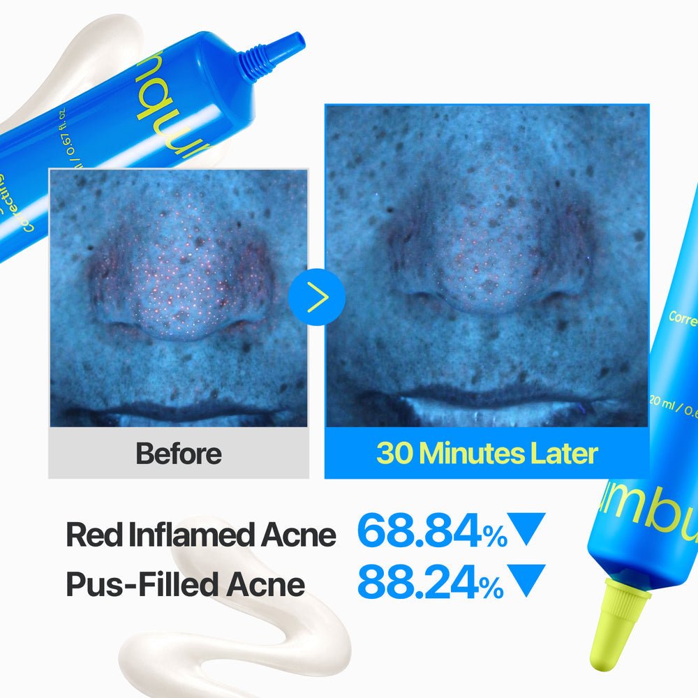numbuzin Zero Blemish 3X Spot Correcting Cream 20ml by numbuzin – Spot Treatment